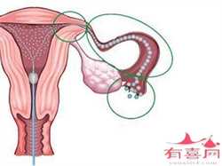 上海助孕招聘,吃“黑米”致不孕4种粗粮对女性生